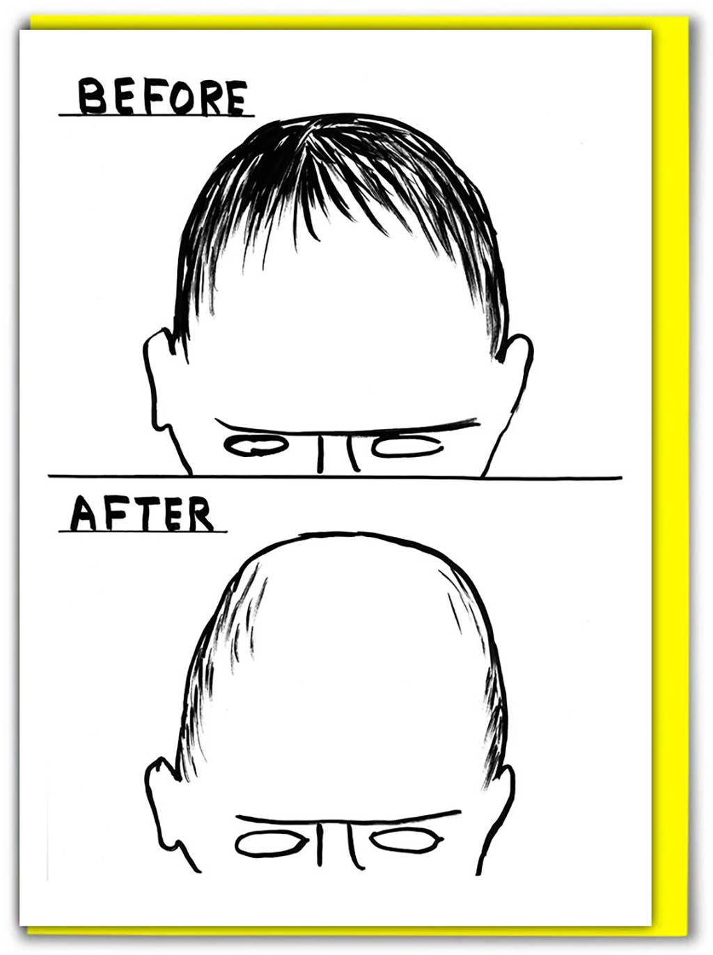 David Shrigley Funny Birthday Card - Before After