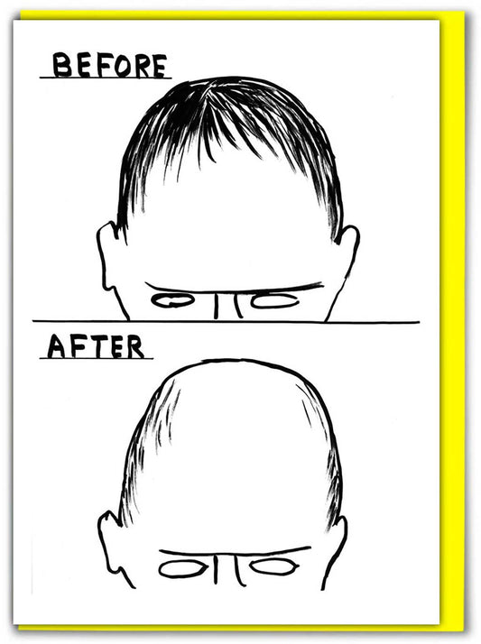 David Shrigley Funny Birthday Card - Before After
